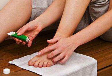 прилагане на мехлем за лечение на гъбички по ноктите на краката