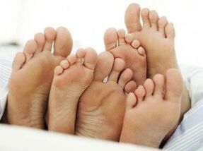 здрави крака след лечение на гъбички между пръстите на краката