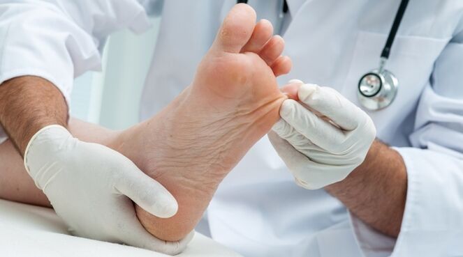 Изследване на нокътната плочка от дерматолог за диагностициране на онихомикоза