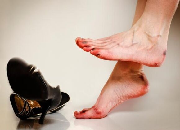 Развитието на гъбички по ноктите на краката може да бъде причинено от тесни обувки